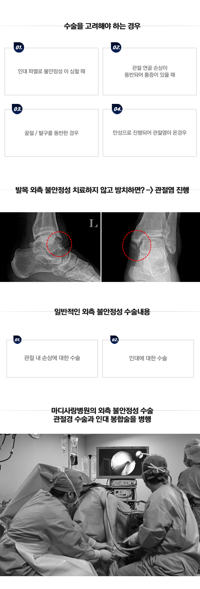 외측 불안정성