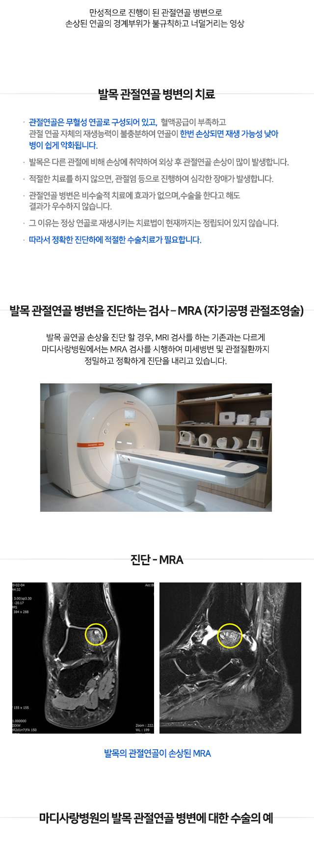 발목 관절연골 병변