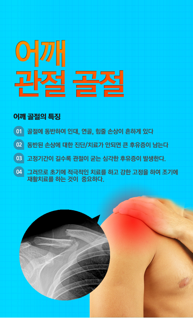 관절주위골절(어깨)