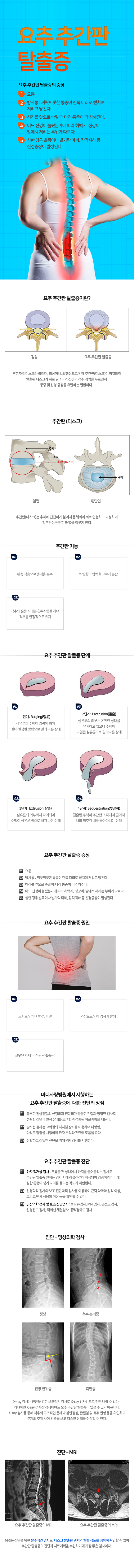 요추추간판탈출증