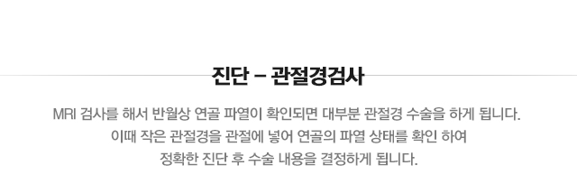 원판형 반월상 연골 파열