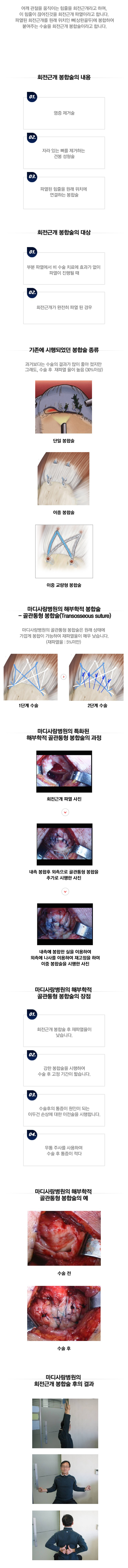 회전근개질환