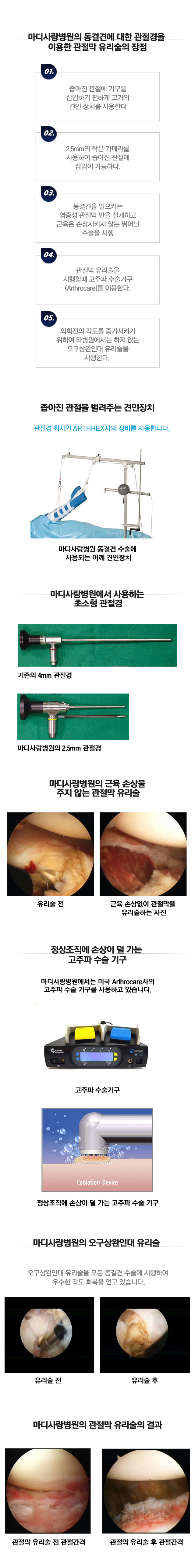 동결견