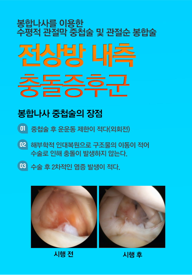 전상방 충돌증후군