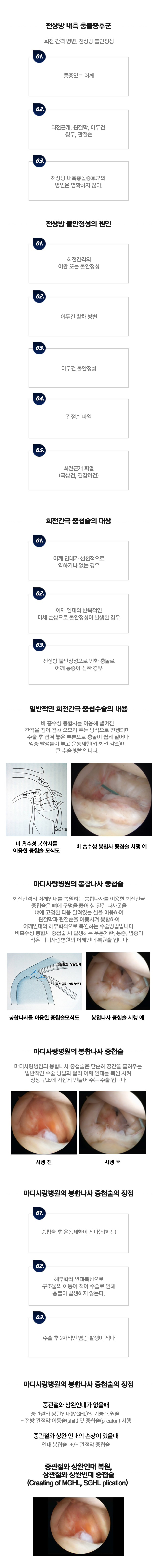 전상방 충돌증후군