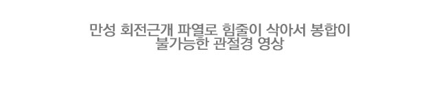 상부관절막재건술