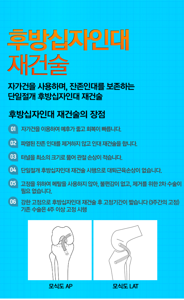 관절연골 재생 수술