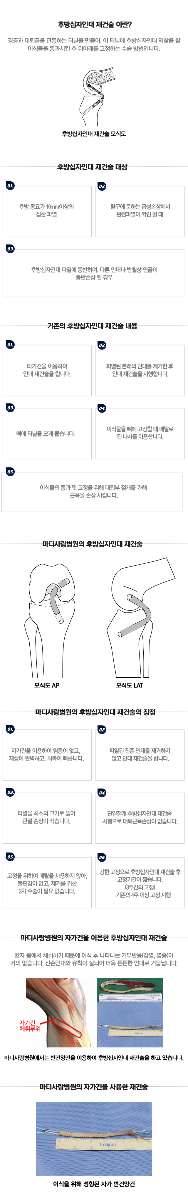 관절연골 재생 수술