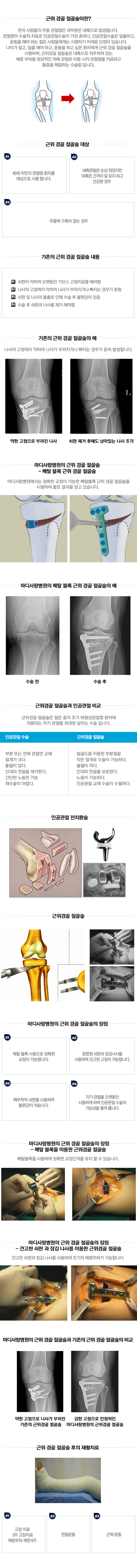 인공관절 부분치환술