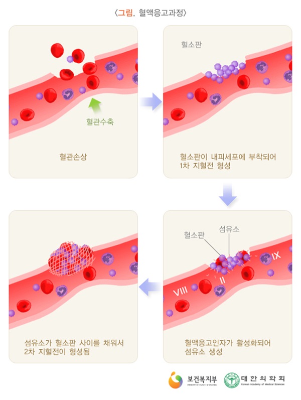 혈액의 구성과 혈액응고에 대해 알아보자, 혈액세포, 지혈과정 : 네이버 블로그 마디사랑병원 - 커뮤니티 > 마디사랑병원블로그” style=”width:100%” title=”마디사랑병원 – 커뮤니티 > 마디사랑병원블로그” loading=”lazy”><figcaption>마디사랑병원 – 커뮤니티 > 마디사랑병원블로그</figcaption></figure>
<figure><img decoding=