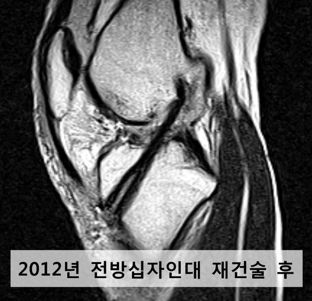 마디사랑병원 - 커뮤니티 > 마디사랑병원블로그