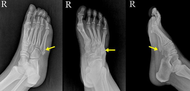 마디사랑병원 - Community > Blog