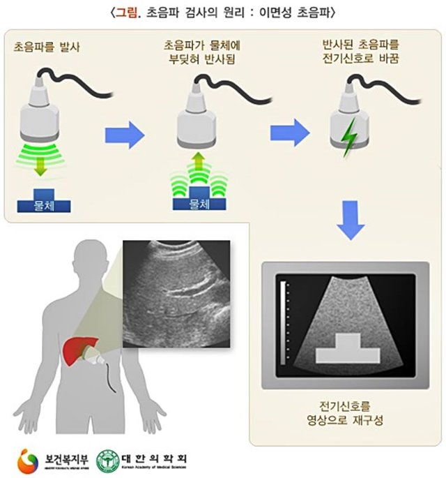 마디사랑병원 ㅣ 관절, 척추, 재활, 줄기세포 - 커뮤니티 > 마디사랑병원블로그