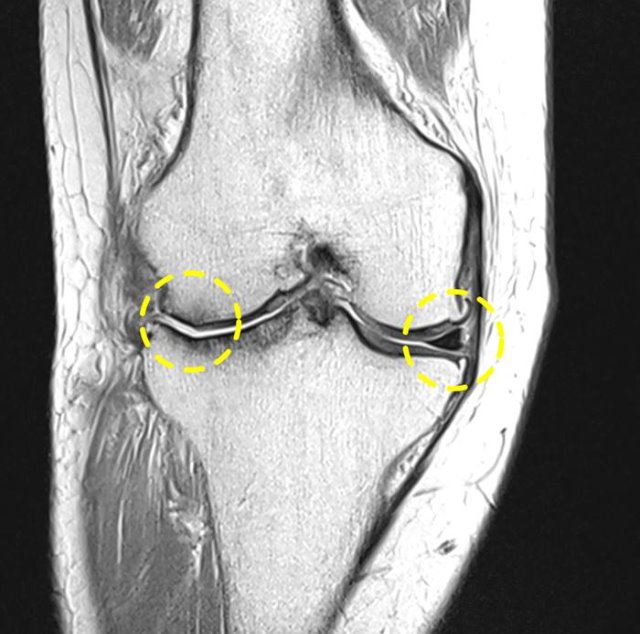 MRI.jpg