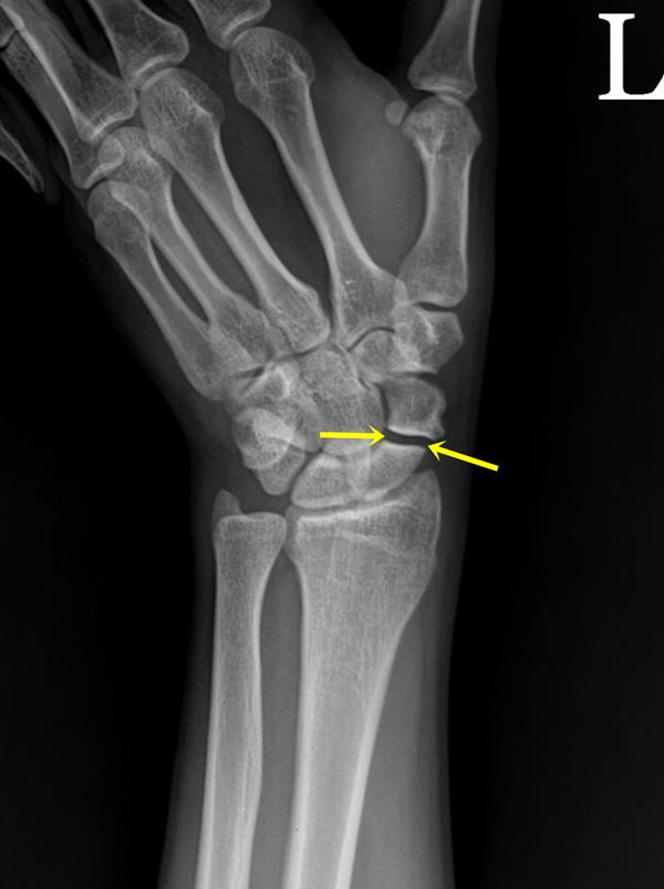 수술 전 x-ray -1.jpg