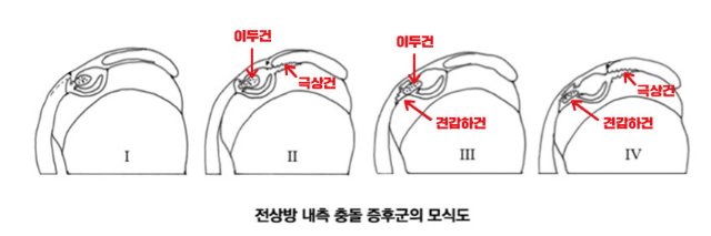 모식도.jpg