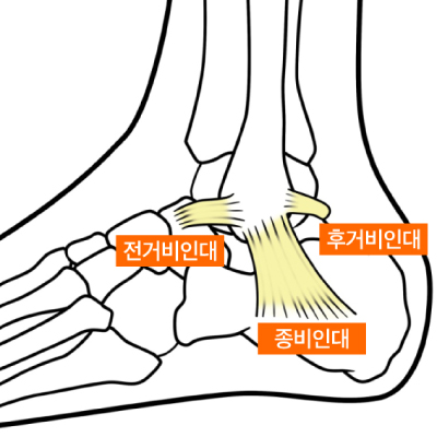 외측인대.jpg