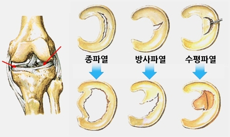 마디사랑병원 - Community > Blog