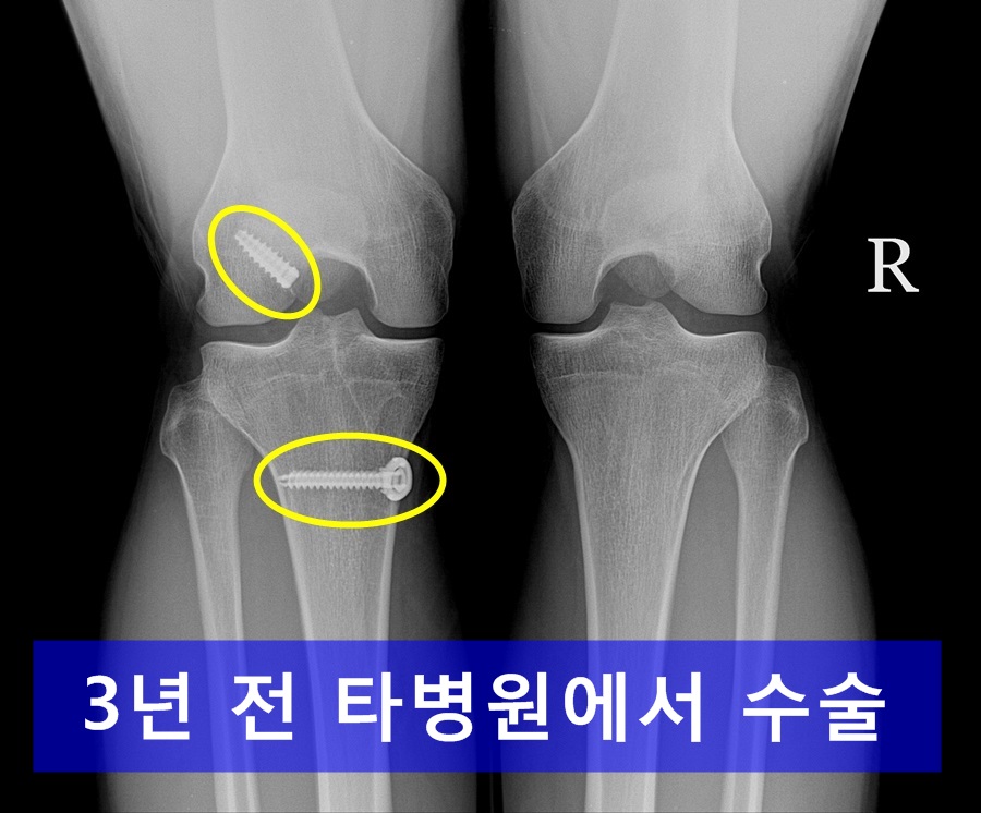 마디사랑병원 - 커뮤니티 > 마디사랑병원블로그