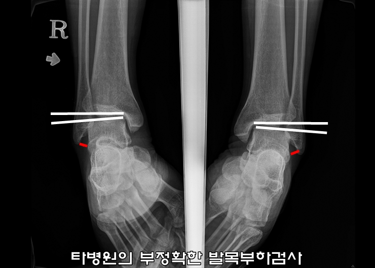 마디사랑병원 - 커뮤니티 > 마디사랑병원블로그
