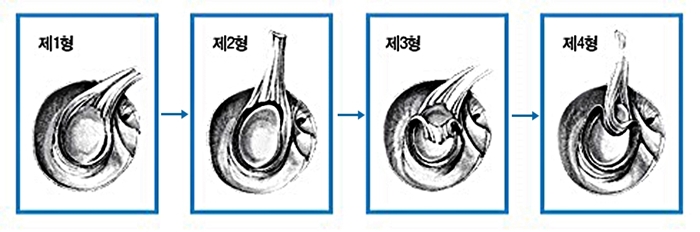 마디사랑병원 - Community > Blog