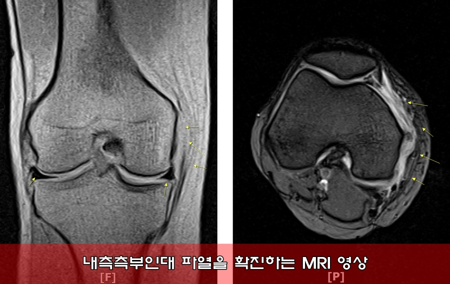 마디사랑병원 - Community > Blog
