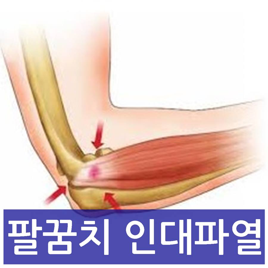 샘플이미지