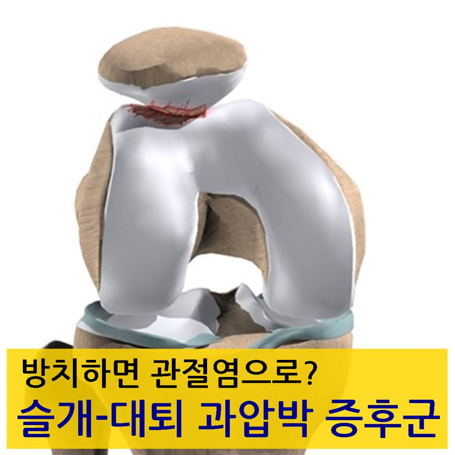 샘플이미지