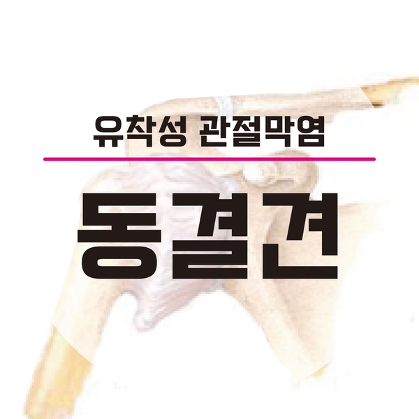 샘플이미지