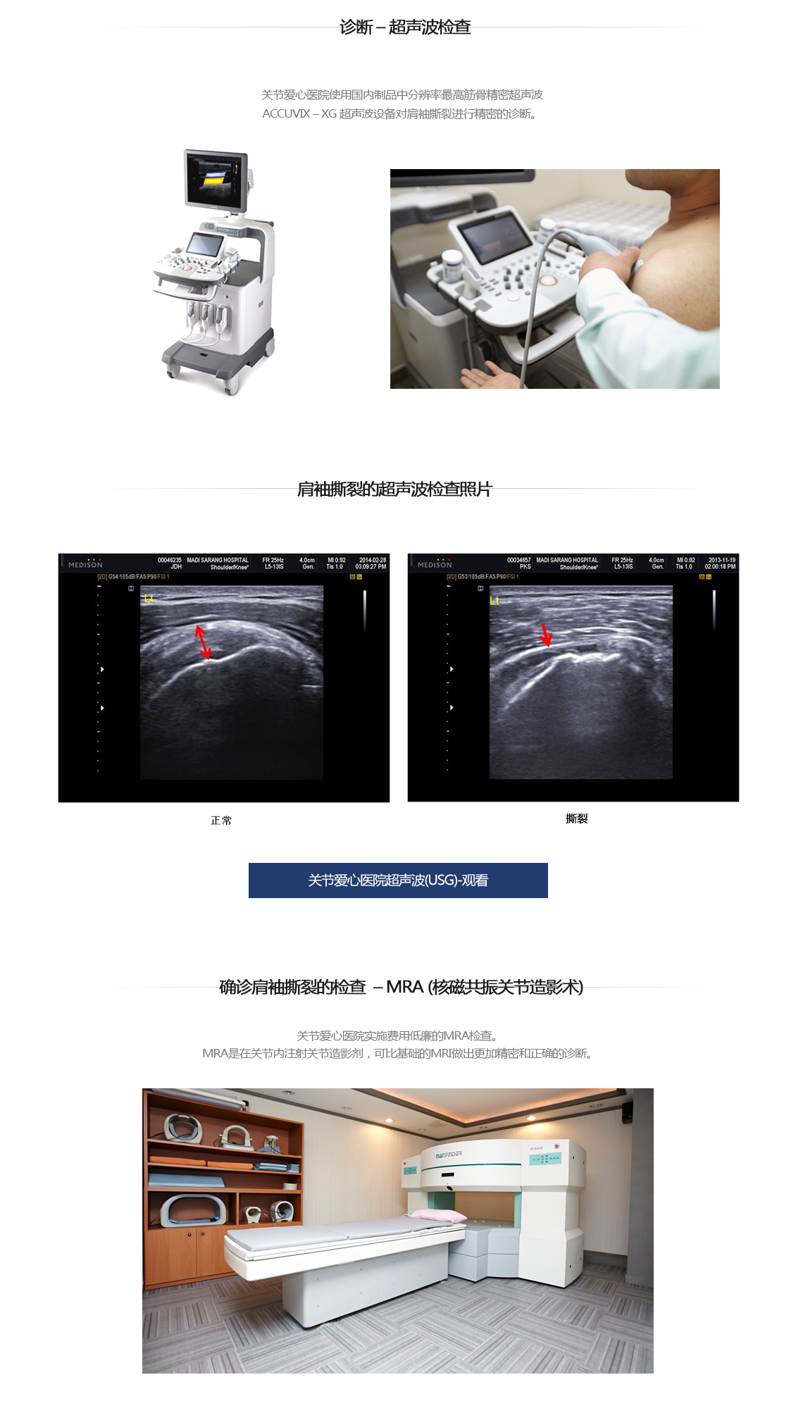 회전근개파열