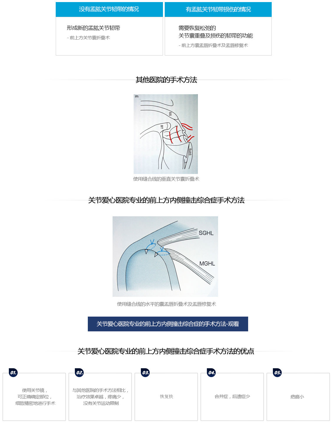 전상방내측충돌증후군