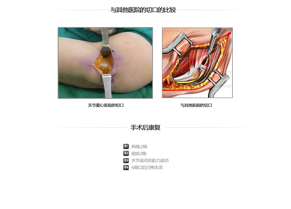 팔꿈치 증상별 진단 