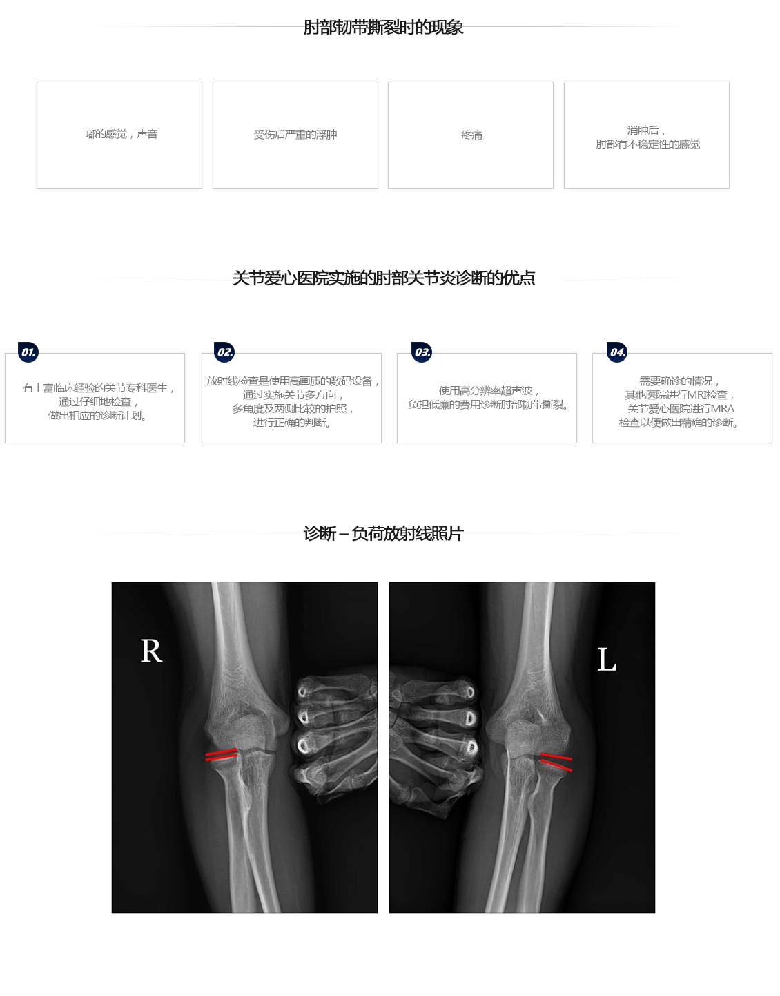 팔꿈치 증상별 진단 