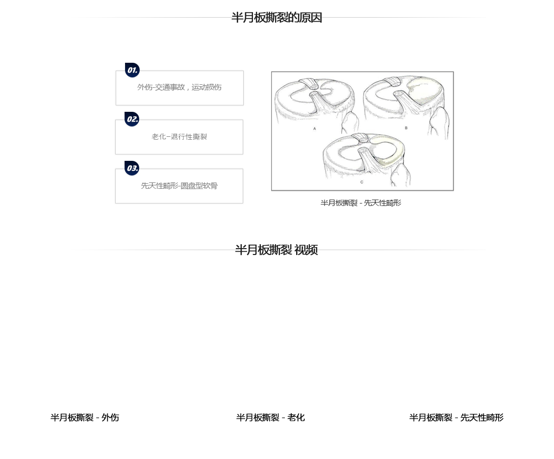 반월상연골파열