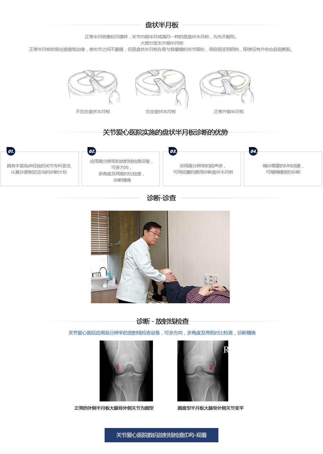 원판형 반월상 연골 파열