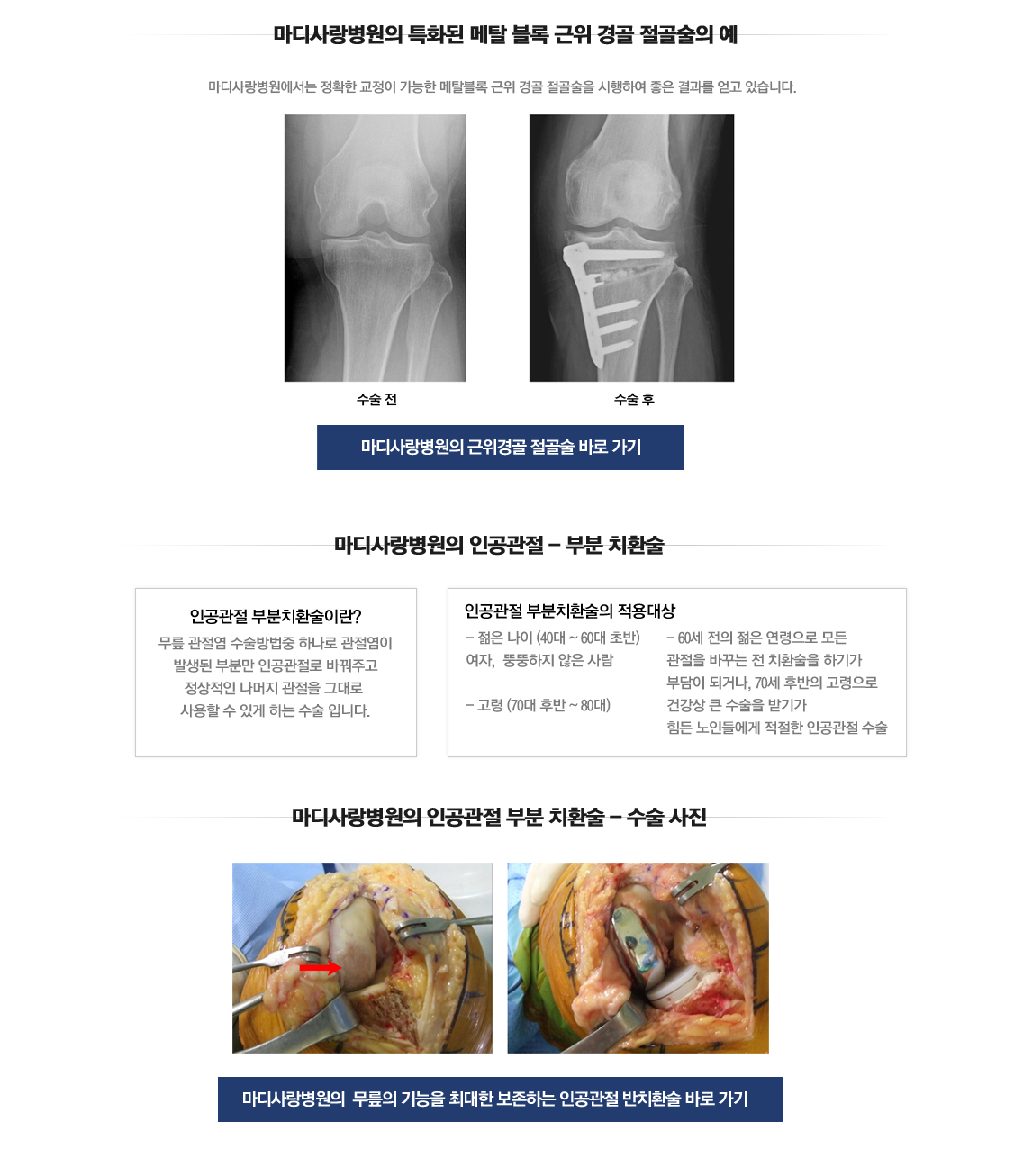 퇴행성관절염