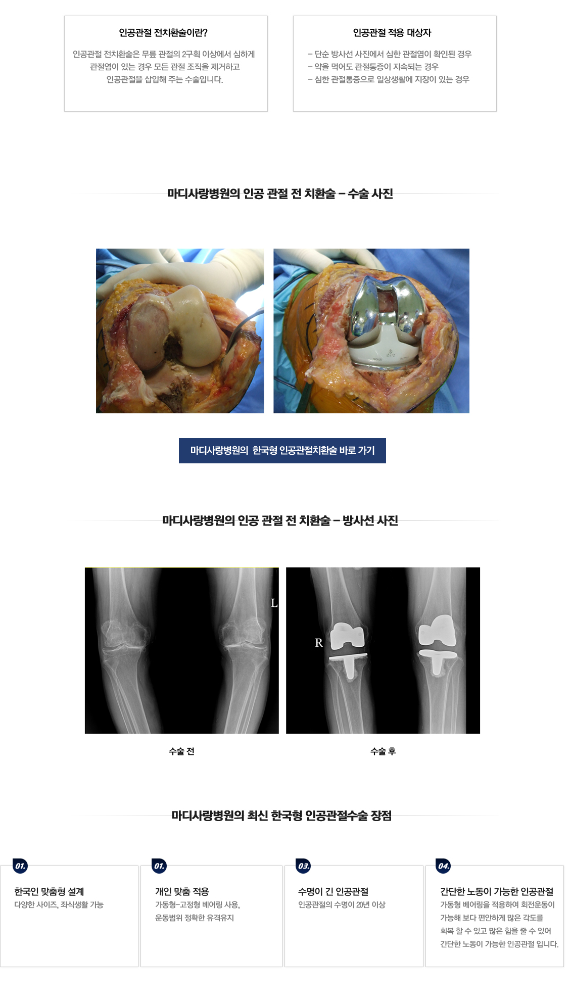 퇴행성관절염