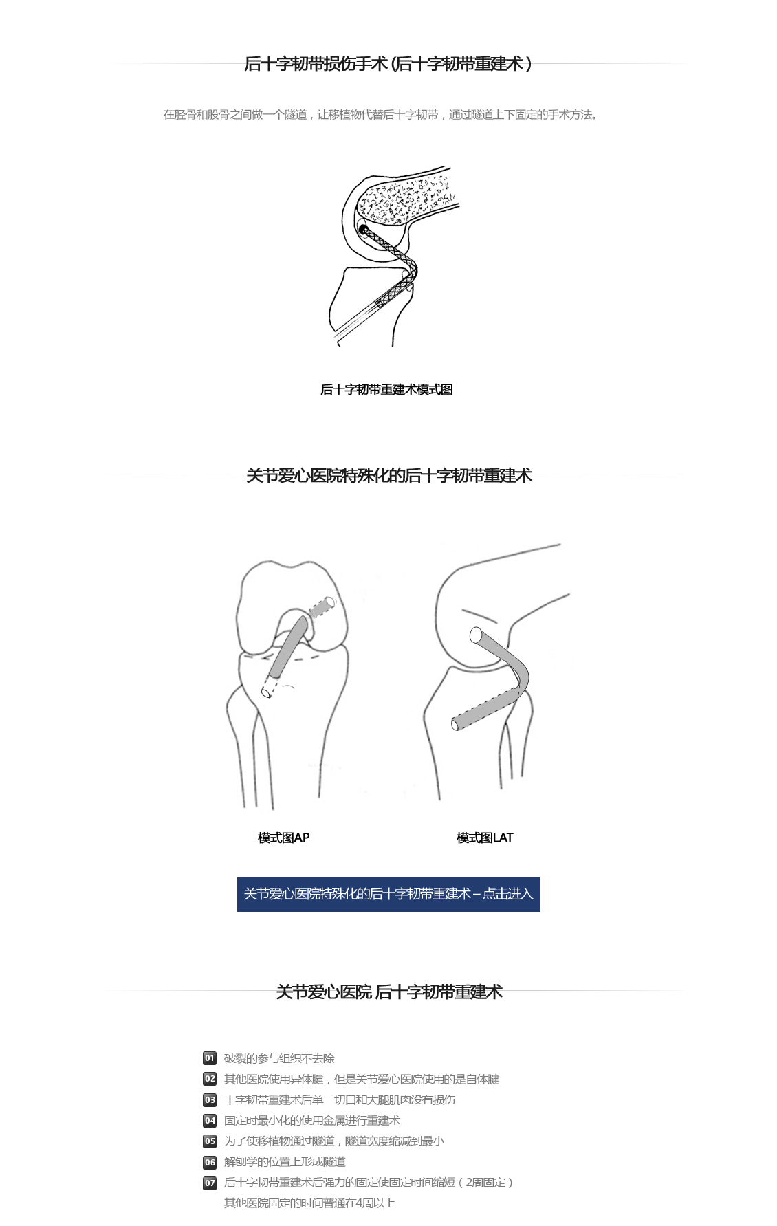 후방십자인대 파열