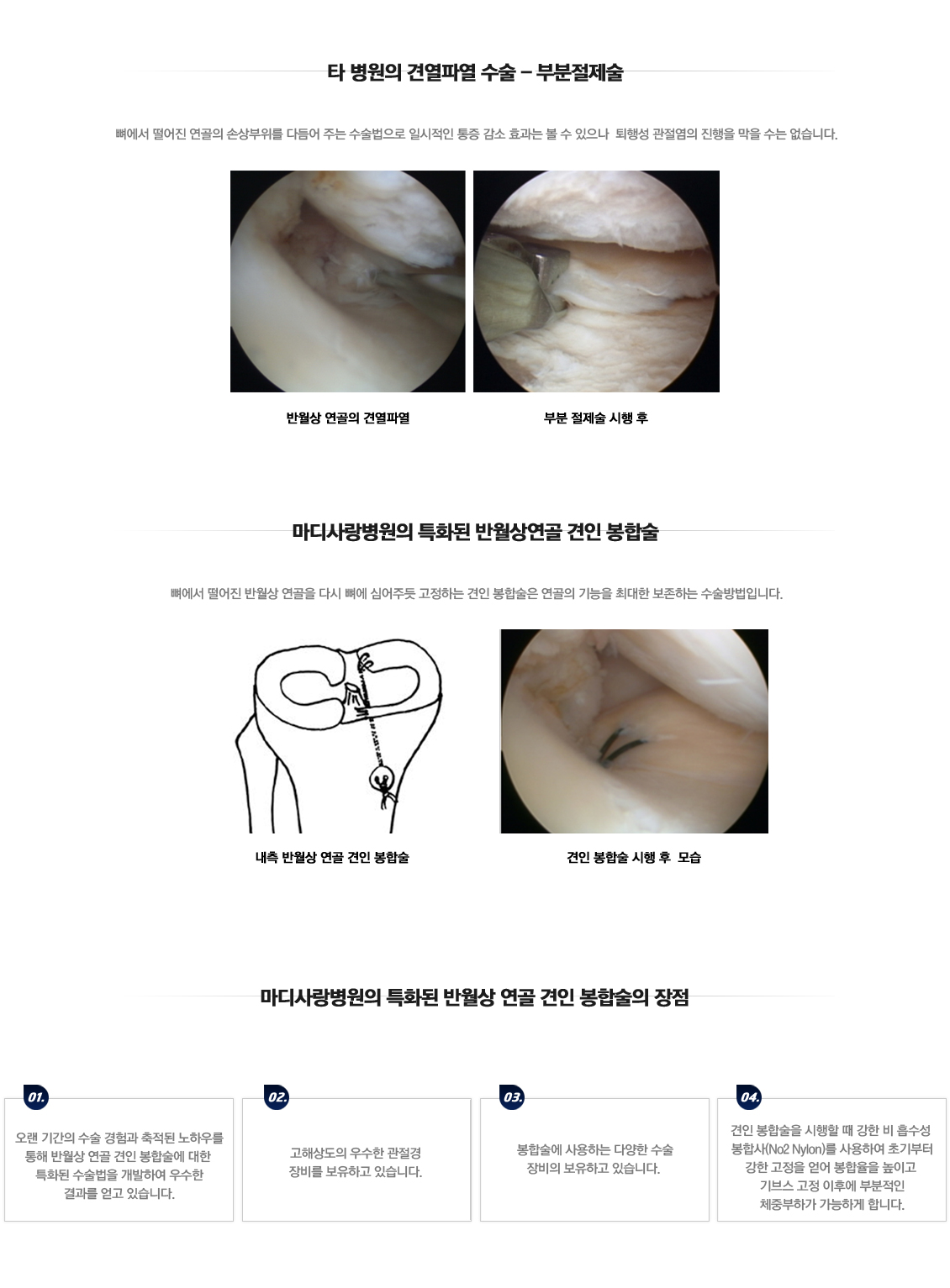 어깨 골절수술