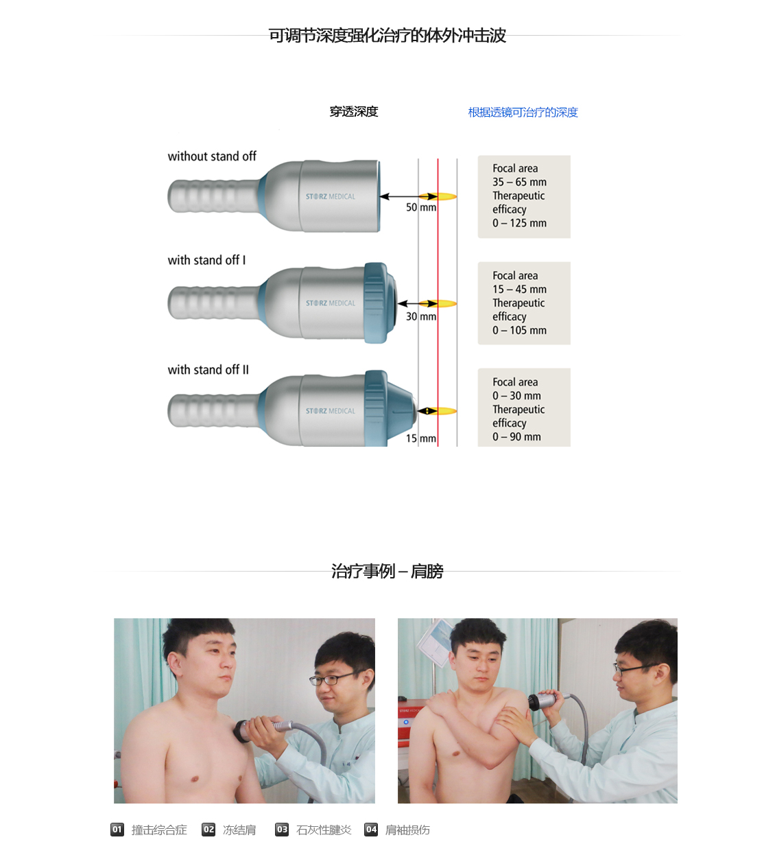 체외충격파(ESWT)