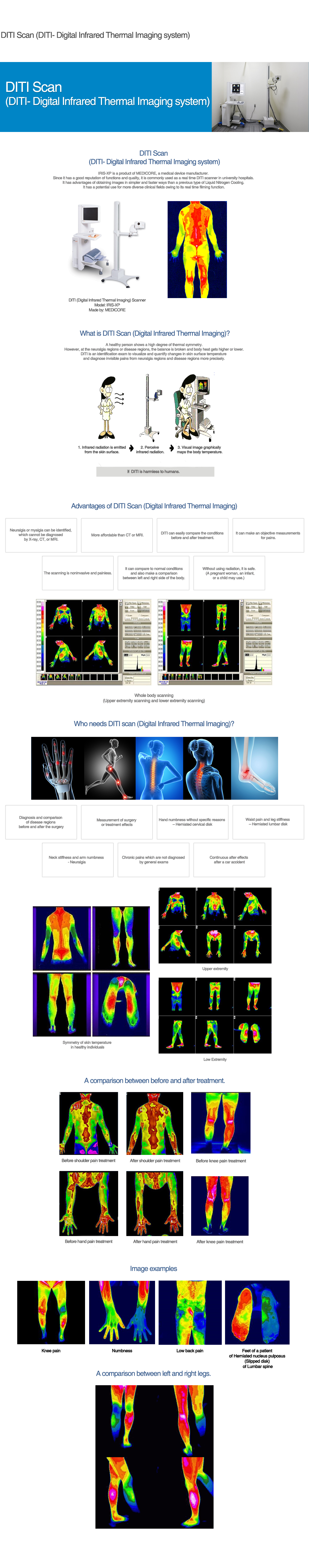 Digital Infrared Thermal Imaging System