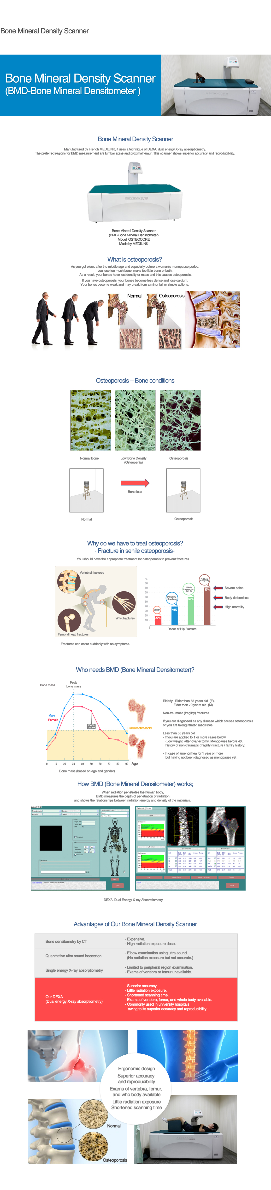 Bone densitometry