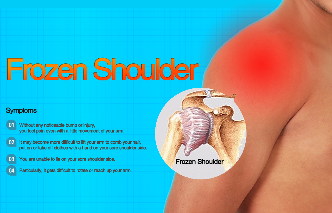 Frozen shoulder