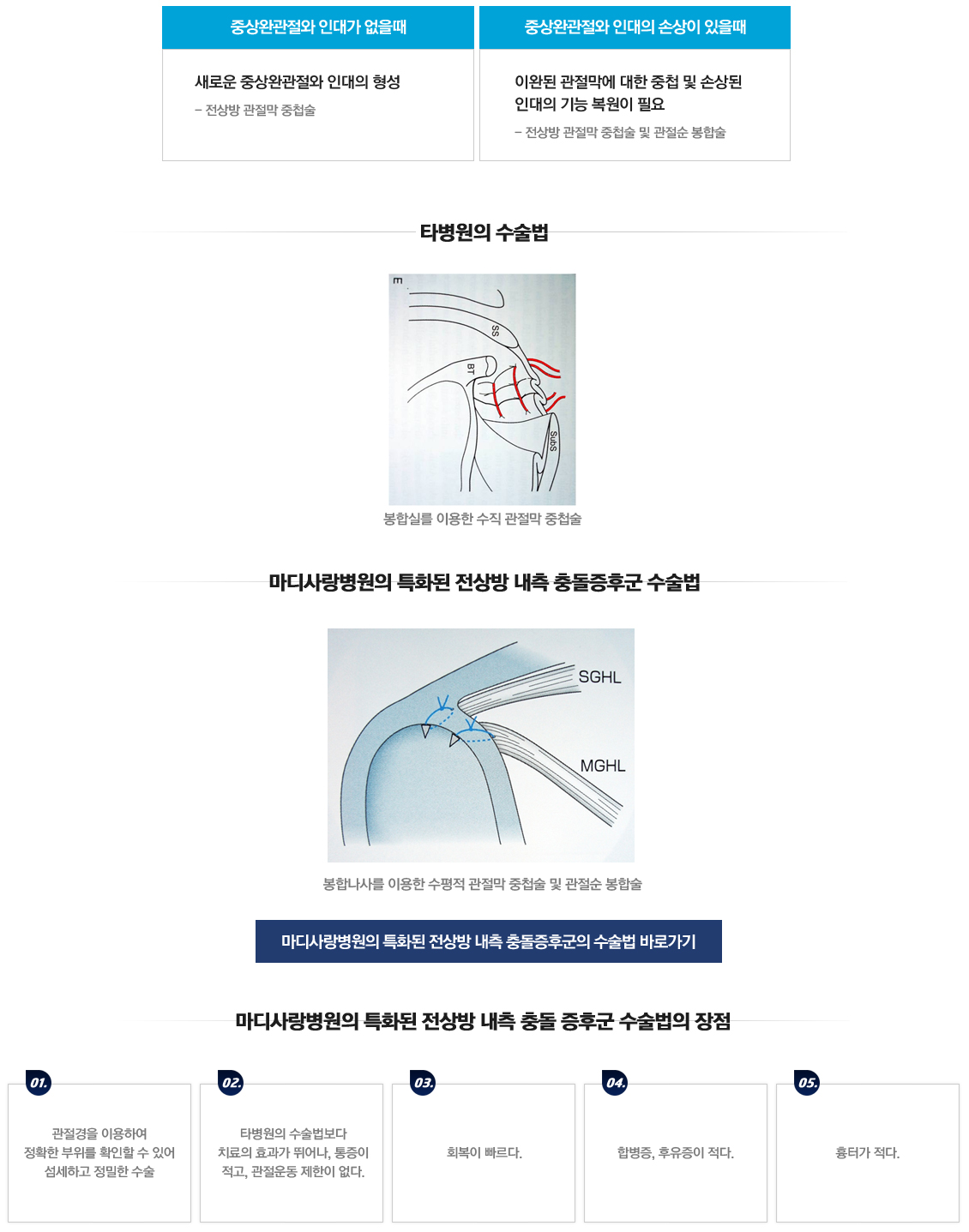 전상방내측Impingement syndrome 