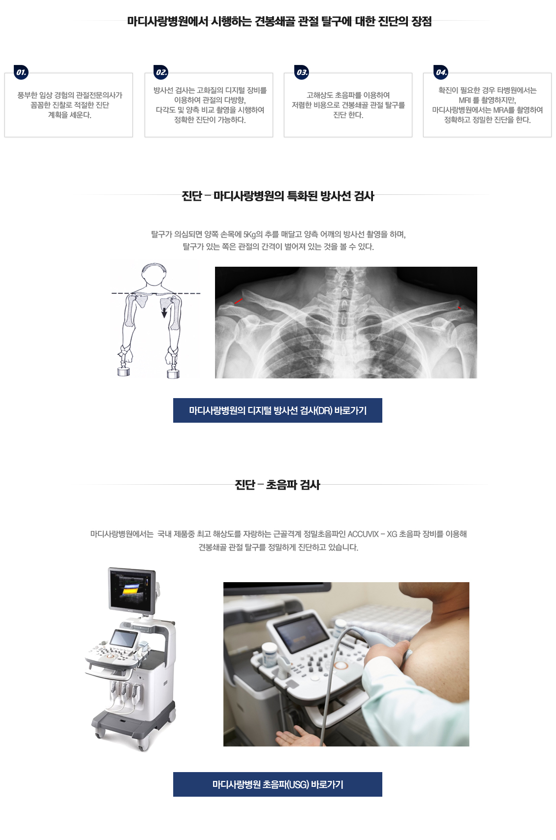 Acromioclavicular dislocation