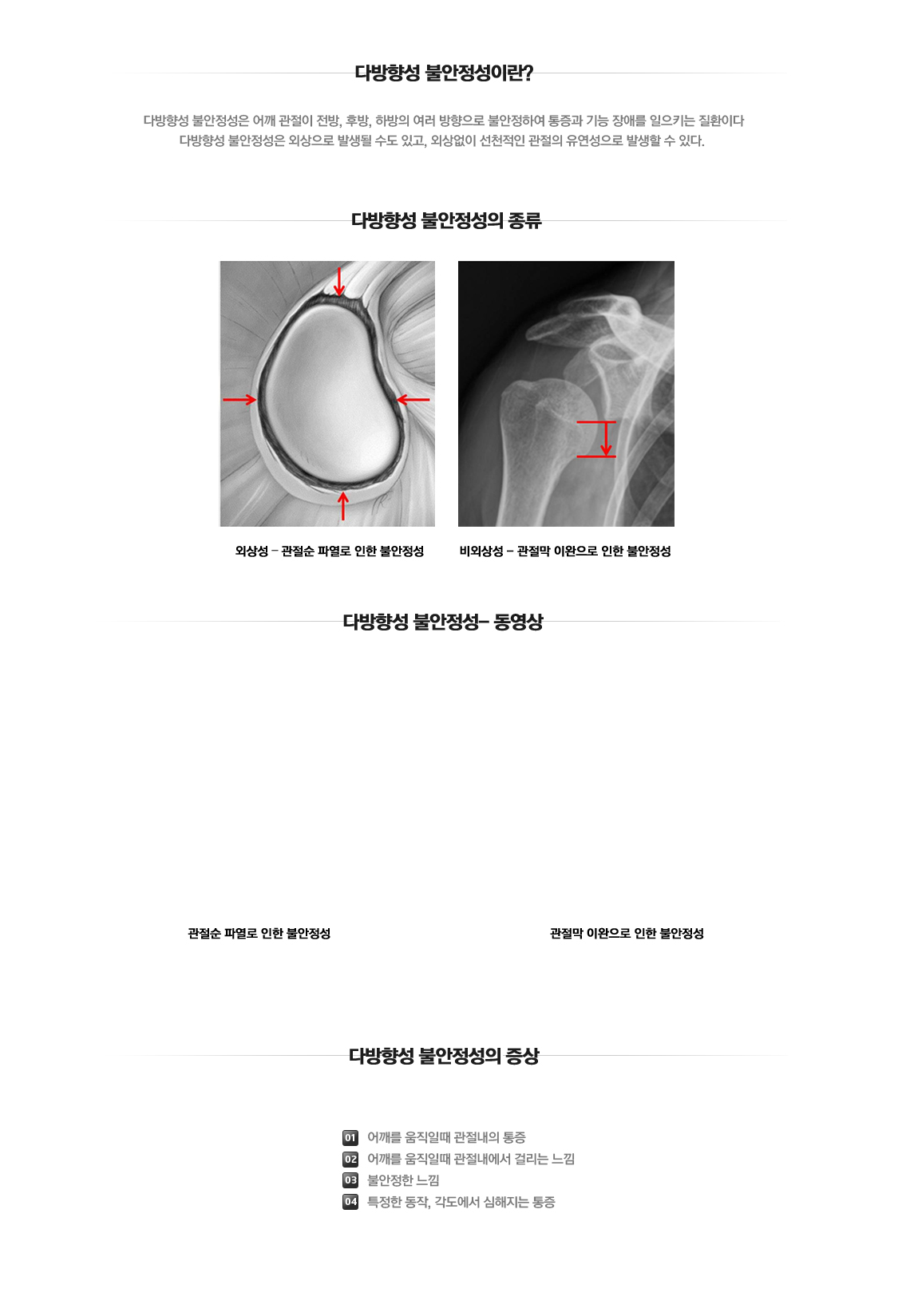 Multi-directional instability