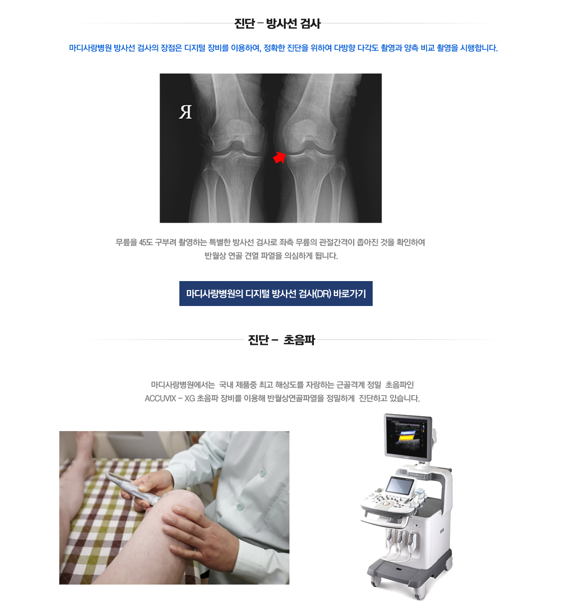 Meniscus Root Tears