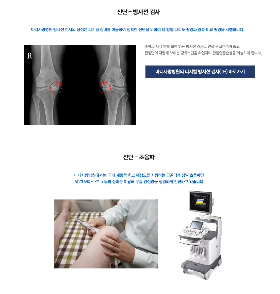 Osteoarthritis