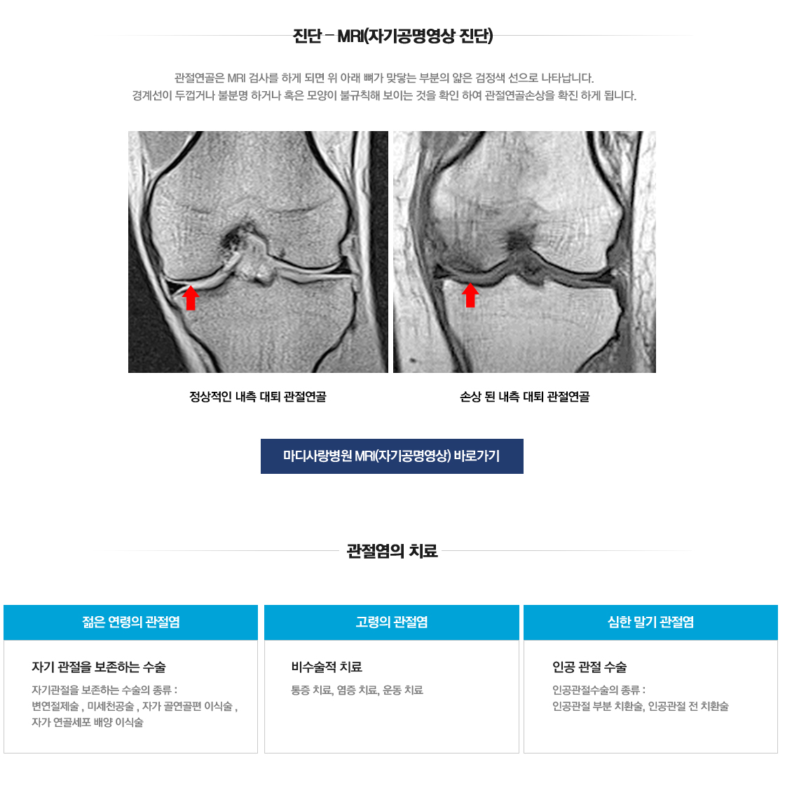 Osteoarthritis