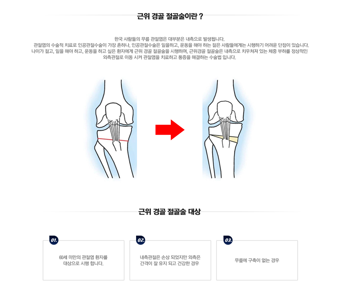 Osteoarthritis